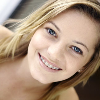 orthodontic faqs