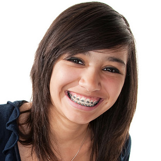 orthodontic retention